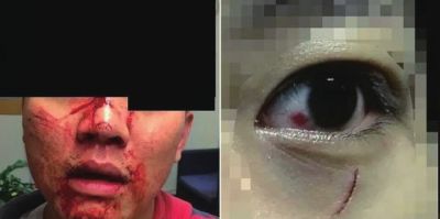 1459913093809888.jpg 20160405080057931.jpg