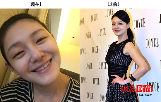 大S幸福生娃后 她曾经的美容金句简直是天雷滚滚