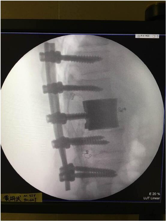 将3D打印引入医疗，华钛三维将加快融资脚步-智慧财经网